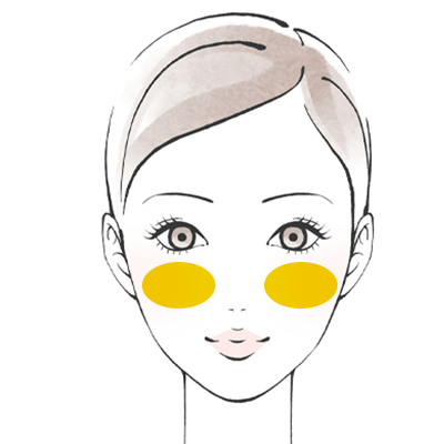 頬骨の骨切り・骨削り